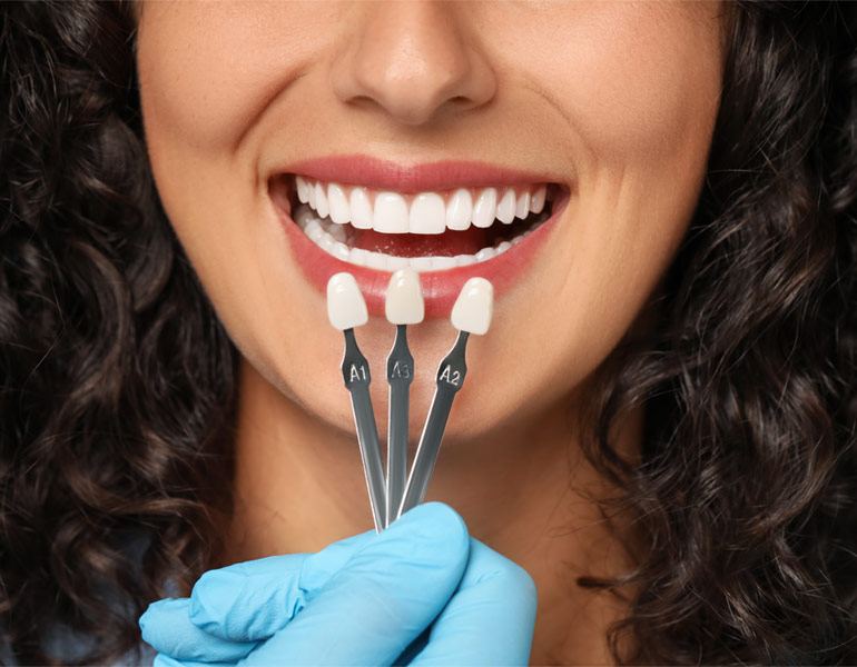 Branqueamento Dentário