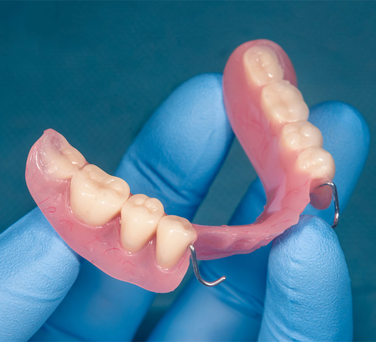 Próteses Dentárias Removíveis