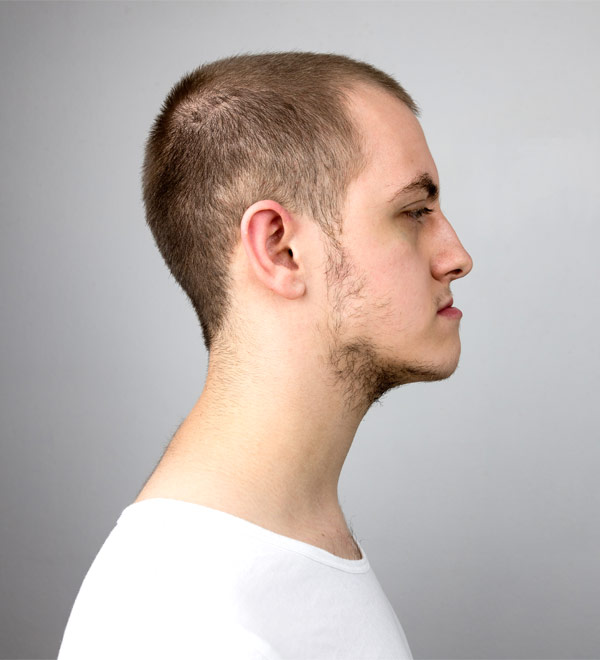 Tratamento de Deformações Dentárias e do Esqueleto Facial