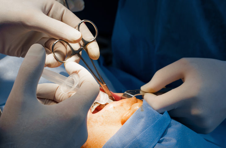 Cirurgia Oral